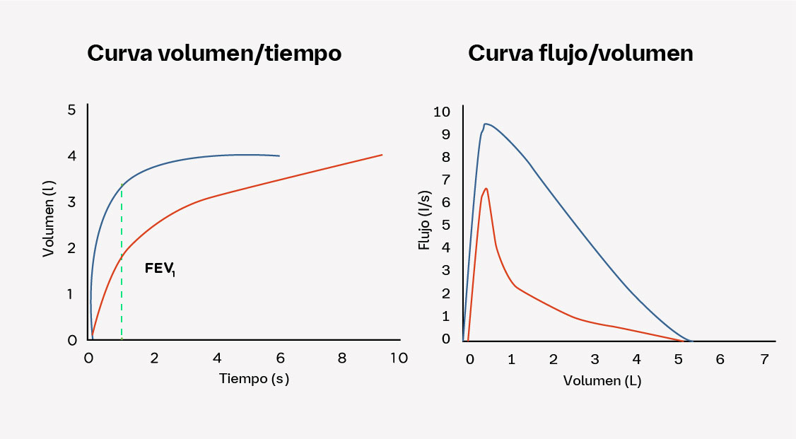 Forma de las curvas