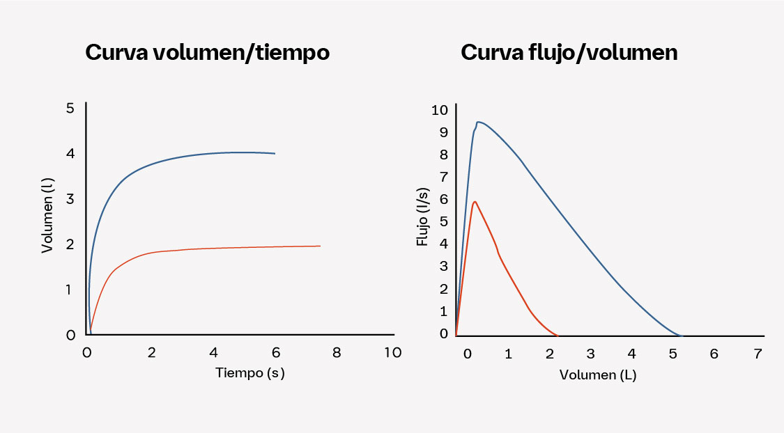 Formas de las curvas