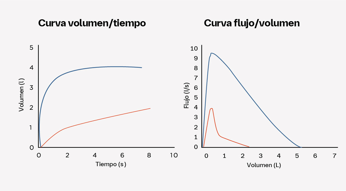 Forma de las curvas